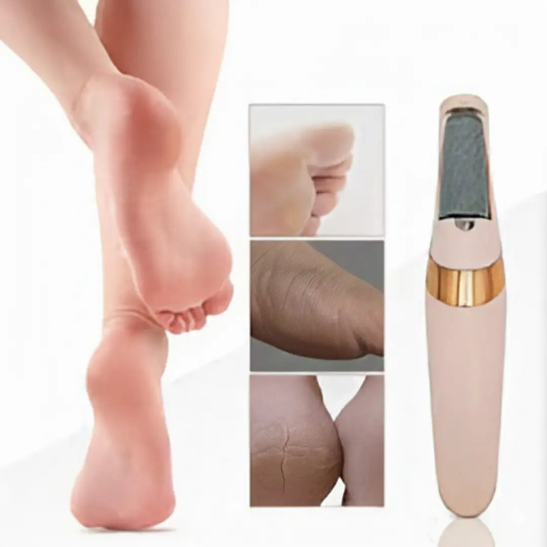 Glower Steps Electric Callus Remover