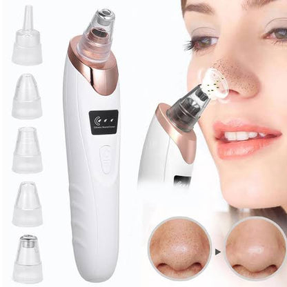 DermaGlow™ 5-in-1 Blackhead Vacuum Pore Cleaner