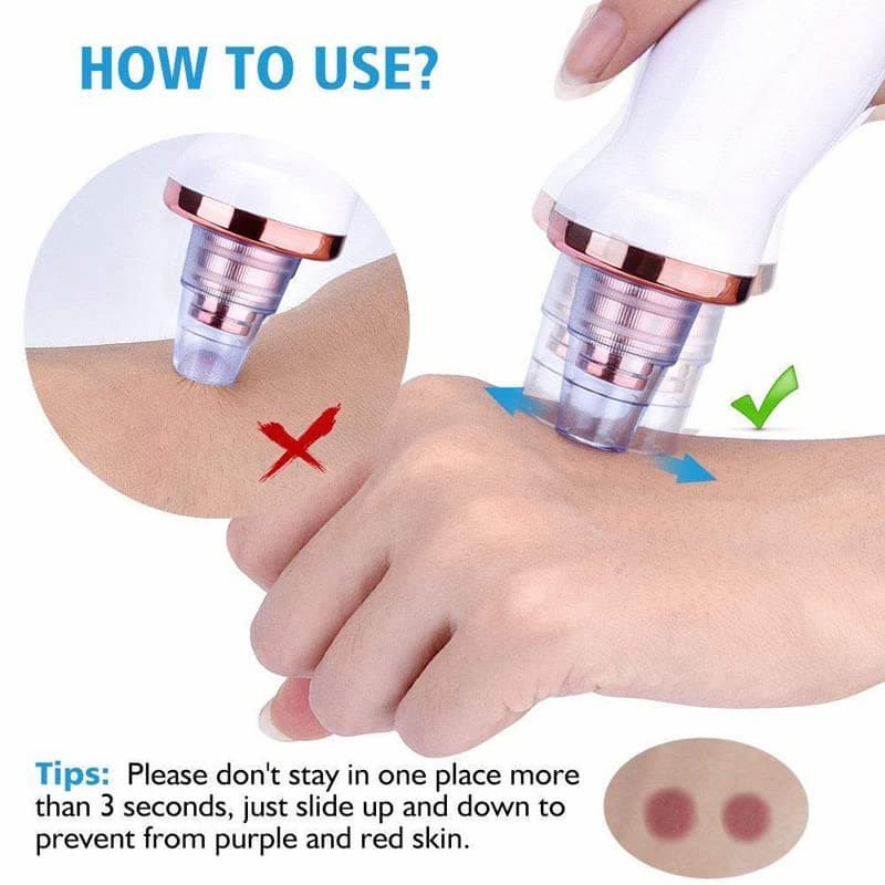 DermaGlow™ 5-in-1 Blackhead Vacuum Pore Cleaner