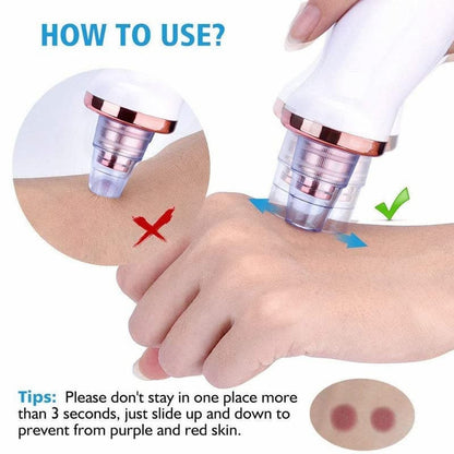 DermaGlow™ 5-in-1 Blackhead Vacuum Pore Cleaner
