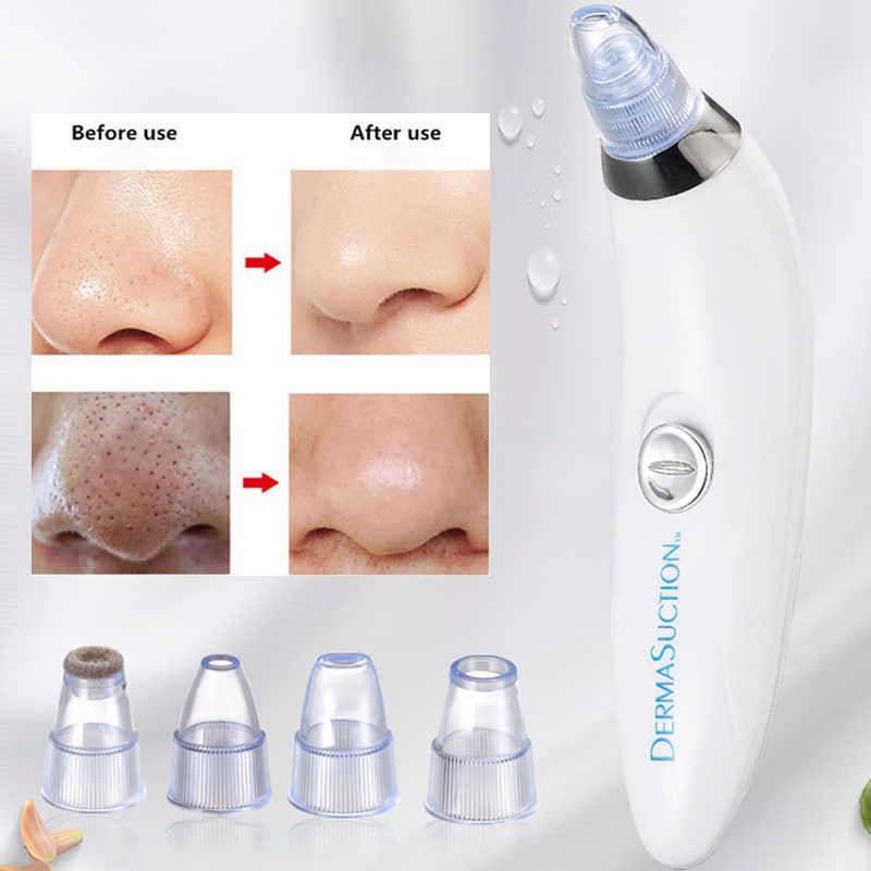 DermaGlow™ 5-in-1 Blackhead Vacuum Pore Cleaner